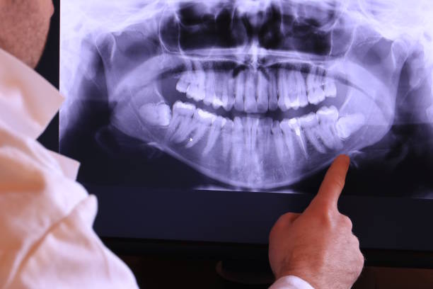Best Pediatric Emergency Dentist in Lake Telemark, NJ