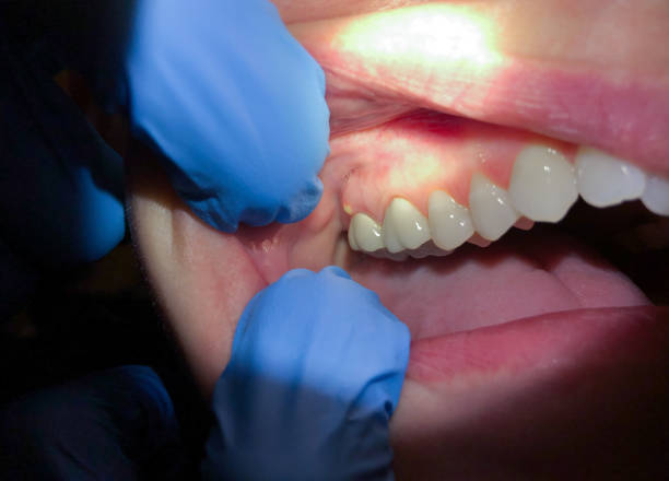 Best Emergency Treatment for Toothache in Lake Telemark, NJ
